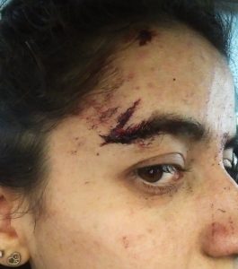 Heridas del accidente